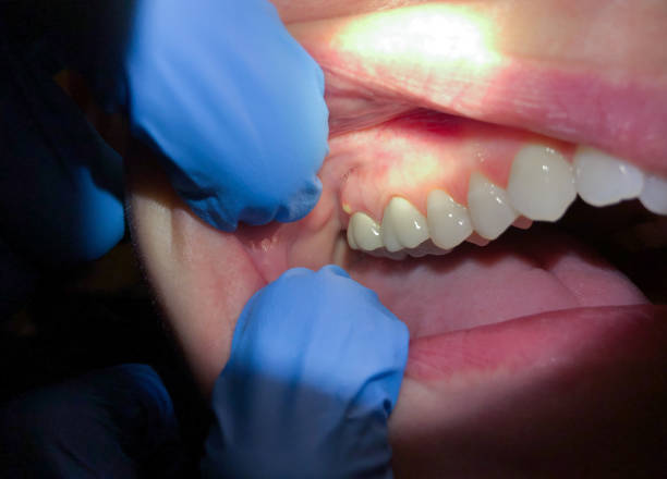 Best Emergency Dental Care for Trauma or Injury in Gardnerville, NV